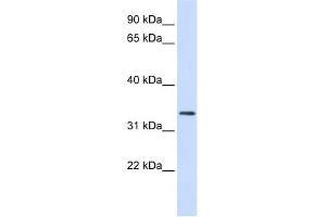 WB Suggested Anti-FBXO25 Antibody Titration:  0. (FBXO25 Antikörper  (N-Term))