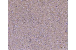 IHC analysis of WDR7 using anti-WDR7 antibody (ABIN7600939).