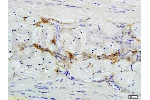 Immunohistochemistry (IHC) image for anti-CD47 (CD47) (AA 241-323) antibody (ABIN739530)