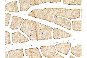 ABIN6260500 and ABIN6268739 at 1/100 staining Rat muscle tissue by IHC-P.