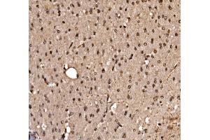 IHC analysis of KLF15 using anti-KLF15 antibody (ABIN7599269). (KLF15 Antikörper  (AA 1-323))