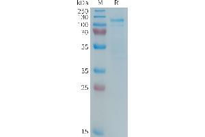 Human Protein, hFc Tag on SDS-PAGE under reducing condition.