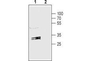 Western blot analysis of rat liver lysate: - 1. (GJB1 Antikörper  (C-Term, Intracellular))