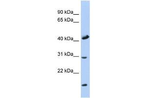 WB Suggested Anti-COX18 Antibody Titration: 0. (COX18 Antikörper  (Middle Region))