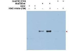 Western blot using  affinity purified anti-ATDC (Ac-K116) antibody shows detection of a 66 kDa band corresponding to over-expressed, acetylated lysine (K116) ATDC (arrowhead) in transfected 293T cells. (TRIM29 Antikörper  (Internal Region))
