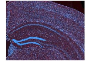 Immunofluorescence (IF) image for anti-Amyloid beta (Abeta) (C-Term) antibody (ABIN5508784)