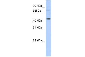 WB Suggested Anti-LMX1A Antibody Titration:  5. (LMX1A Antikörper  (C-Term))