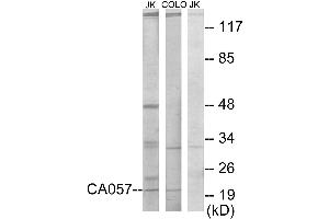 Western blot analysis of extracts from Jurkat cells and COLO205 cells, using CA057 antibody. (C1orf57 Antikörper)