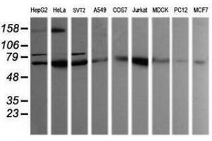 Image no. 2 for anti-SEC14 and Spectrin Domains 1 (SESTD1) antibody (ABIN1501067) (SESTD1 Antikörper)