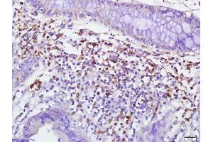 Immunohistochemistry (Paraffin-embedded Sections) (IHC (p)) image for anti-Membrane Metallo-Endopeptidase (MME) (AA 501-600) antibody (ABIN669666)