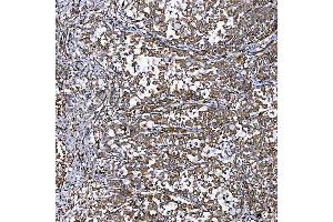 IHC analysis of SEMA4F using anti-SEMA4F antibody (ABIN7601432).