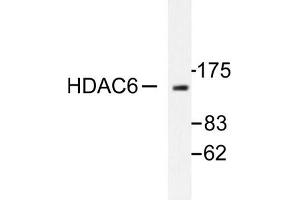 Image no. 1 for anti-Histone Deacetylase 6 (HDAC6) antibody (ABIN265458) (HDAC6 Antikörper)