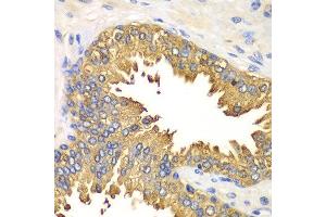 Immunohistochemistry of paraffin-embedded human prostate using DDX58 antibody at dilution of 1:100 (x40 lens).