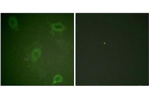 Immunofluorescence staining of methanol-fixed HeLa cells using Amyloid β A4 (phospho-Thr743/668) Antibody. (APP Antikörper  (pThr743))