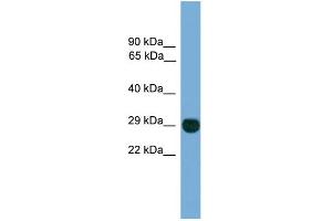 WB Suggested Anti-EIF4E2 Antibody Titration: 0. (EIF4E2 Antikörper  (N-Term))