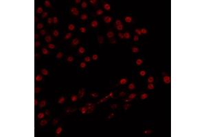 ABIN6266824 staining 293 by IF/ICC. (ZMYND8 Antikörper  (Internal Region))