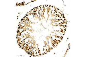 Immunohistochemistry (Paraffin-embedded Sections) (IHC (p)) image for anti-Ring Finger Protein 7 (RNF7) antibody (ABIN7075471)