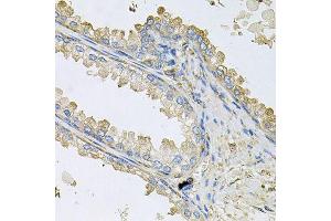 Immunohistochemistry of paraffin-embedded human prostate using PPIC antibody (ABIN6003569) at dilution of 1/100 (40x lens).