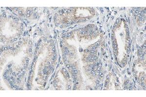 ABIN6276862 at 1/100 staining Human prostate tissue by IHC-P. (FKBP1A Antikörper  (N-Term))