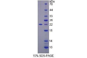 Image no. 1 for Spermine Oxidase (SMOX) (AA 1-165) protein (His tag) (ABIN6236923) (SMOX Protein (AA 1-165) (His tag))