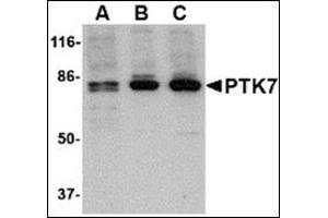 Western blot analysis of PTK7 in (A) human, (B) mouse and (C) rat colon tissue lysate with this product at 1 μg/ml. (PTK7 Antikörper  (N-Term))