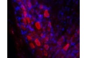 Expression of Galanin receptor 2 in rat DRGImmunohistochemical staining of rat dorsal root ganglia (DRG) frozen sections using Anti-GALR2 Antibody (ABIN7043181, ABIN7044398 and ABIN7044399), (1:100). (Galanin Receptor 2 (GALR2) Peptid)