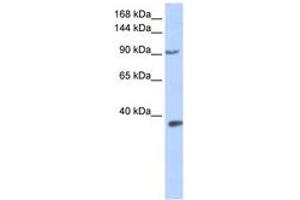 Image no. 1 for anti-Endothelial PAS Domain Protein 1 (EPAS1) (AA 360-409) antibody (ABIN6742258) (EPAS1 Antikörper  (AA 360-409))