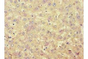 Immunohistochemistry of paraffin-embedded human liver tissue using ABIN7142945 at dilution of 1:100 (ACAT1 Antikörper  (AA 1-145))