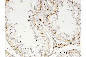 Immunoperoxidase of monoclonal antibody to IL13 on formalin-fixed paraffin-embedded human testis. (IL-13 Antikörper)