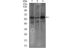 Western blot analysis using FCER1A mouse mAb against SW620 (1), A549 (2), and A431 (3) cell lysate. (Fc epsilon RI/FCER1A Antikörper  (AA 42-103))