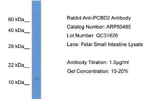 Western Blotting (WB) image for anti-Pterin-4 alpha-Carbinolamine Dehydratase/dimerization Cofactor of Hepatocyte Nuclear Factor 1 alpha (TCF1) 2 (PCBD2) (N-Term) antibody (ABIN2788466) (PCBD2 Antikörper  (N-Term))