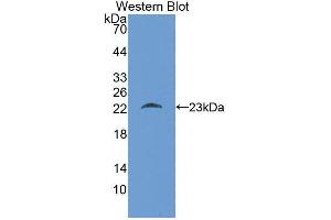 Western blot analysis of the recombinant protein. (KIT Antikörper)