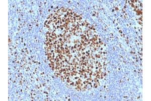 Formalin-fixed, paraffin-embedded human Tonsil stained with MCM7 Monoclonal Antibody (SPM379). (MCM7 Antikörper)