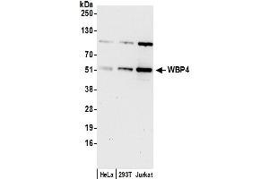 anti-WW Domain Binding Protein 4 (WBP4) (AA 125-175) antibody
