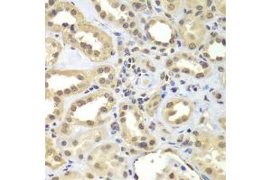 Immunohistochemistry of paraffin-embedded human kidney using SUPT20H antibody (ABIN5975125) at dilution of 1/100 (40x lens). (FAM48A/P38IP Antikörper)