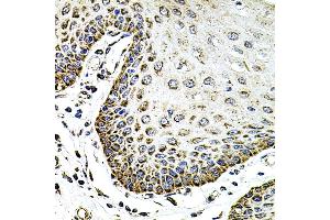 Immunohistochemistry of paraffin-embedded human esophagus using SDC2 antibody (ABIN3022587, ABIN3022588, ABIN3022589 and ABIN6218928) at dilution of 1:100 (40x lens). (Syndecan 2 Antikörper  (AA 19-144))