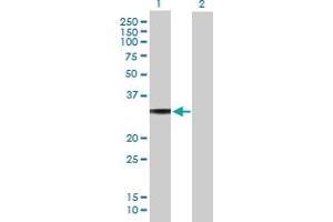 Western Blot analysis of GNAO1 expression in transfected 293T cell line by GNAO1 MaxPab polyclonal antibody. (GNAO1 Antikörper  (AA 1-302))