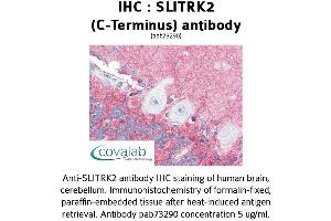 Image no. 1 for anti-SLIT and NTRK-Like Family, Member 2 (SLITRK2) (C-Term) antibody (ABIN1739438) (SLITRK2 Antikörper  (C-Term))