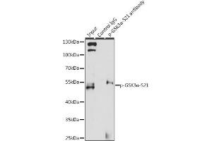 Immunoprecipitation analysis of 200 μg extracts of 293T cells, using 3 μg Phospho-GSK3α-S21 pAb (ABIN6135231, ABIN6136096, ABIN6136097 and ABIN6225606). (GSK3 alpha Antikörper  (pSer21))
