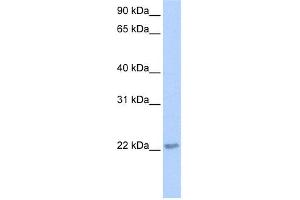 WB Suggested Anti-TCEAL2 Antibody Titration:  0.