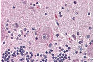 Human Brain, Cerebellum (formalin-fixed, paraffin-embedded) stained with NTSR2 antibody ABIN399994 at 10 ug/ml followed by biotinylated goat anti-rabbit IgG secondary antibody ABIN481713, alkaline phosphatase-streptavidin and chromogen. (NTSR2 Antikörper  (Internal Region))