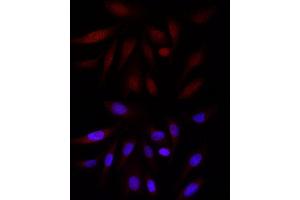 Immunofluorescence (IF) image for anti-E1A Binding Protein P300 (EP300) (AA 1-270) antibody (ABIN6140193)