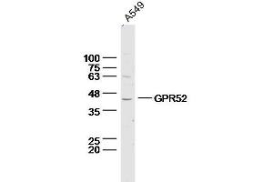 Lane 1: A549 lysates probed with Anti –GPR52 Polyclonal Antibody, Unconjugated (bs-13539R) at 1:300 overnight at 4˚C. (GPR52 Antikörper  (AA 151-250))