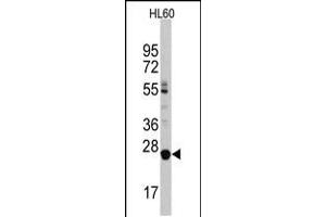 Western blot analysis of LIN28B Antibody in HL60 cell line lysates (35ug/lane) (LIN28B Antikörper  (C-Term))