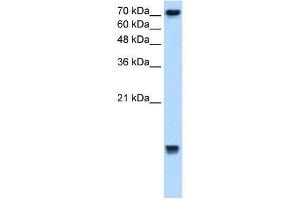 WB Suggested Anti-UBE2N  Antibody Titration: 2. (UBE2N Antikörper  (Middle Region))