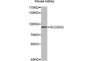 Western blot analysis of extracts of mouse kidney, using SLC22A2 antibody (ABIN6291468) at 1:1000 dilution. (SLC22A2 Antikörper)