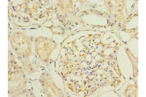 Immunohistochemistry of paraffin-embedded human kidney tissue using ABIN7170183 at dilution of 1:100 (SLC25A33 Antikörper  (AA 66-120))