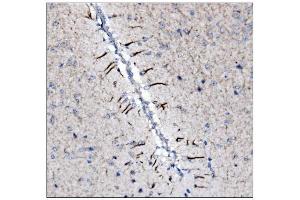 IHC analysis of Alpha Internexin/INA using anti-Alpha Internexin/INA antibody (ABIN7602187). (INA Antikörper  (AA 62-169))