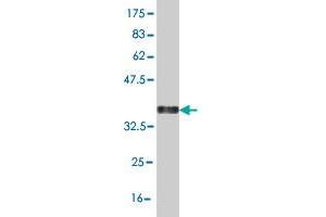 Western Blot detection against Immunogen (37.