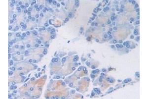 Detection of vWF in Rat Pancreas Tissue using Polyclonal Antibody to Von Willebrand Factor (vWF) (VWF Antikörper  (AA 269-367))